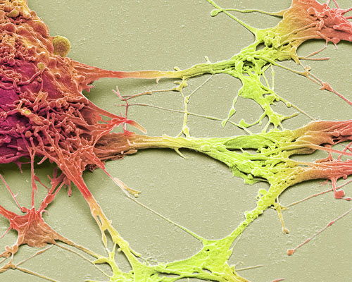 Southern Cross COVID-19 information for health care providers Microscopic image of neurones