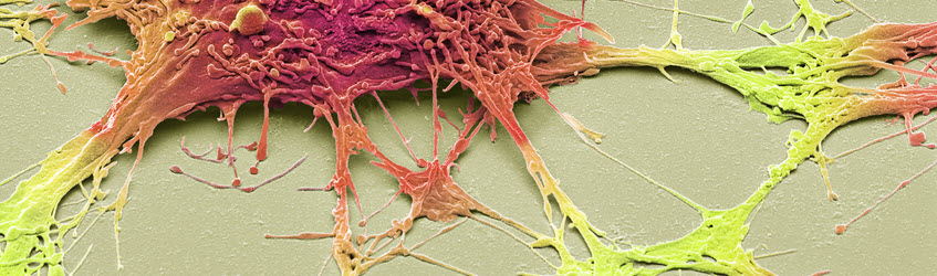 Southern Cross COVID-19 information for health care providers Microscopic image of neurones